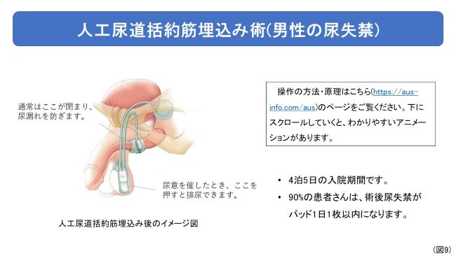 男性尿失禁(前立腺がん手術後、前立腺肥大手術後)